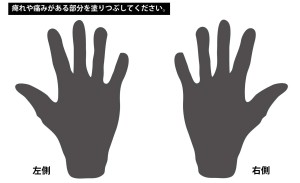 手根管症候群の症状分布図（Hand diagram）