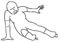 肘関節脱臼,受傷機転,スケート