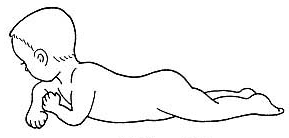 脳性麻痺 リハビリ|ハイハイ