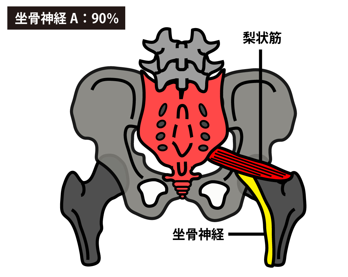 坐骨神経は梨状筋の下を通過する