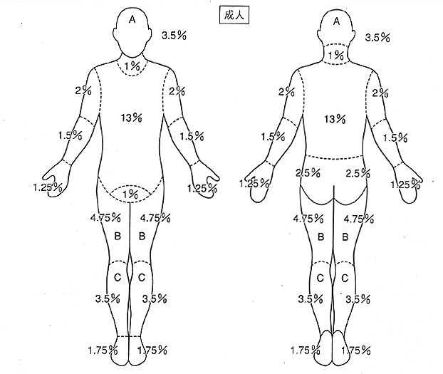 Lund–Browder 図:年齢別の体表面積比率