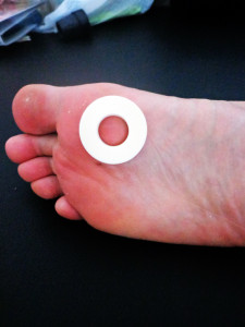 うおの目パッドの効果