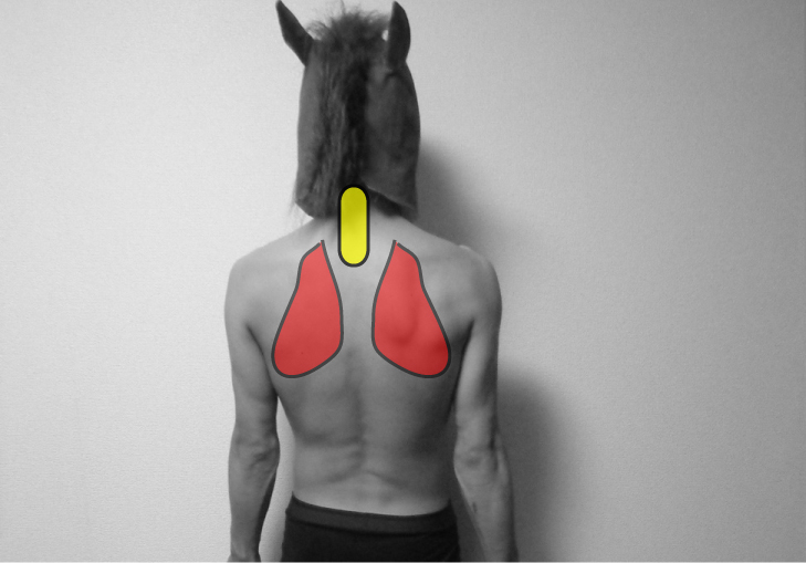 呼吸音の分類と方法２