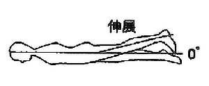 股関節伸展の関節可動域（参考値）