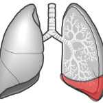 胸水貯留の聴診部位