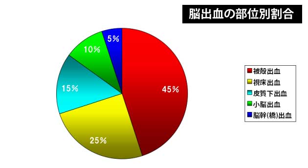 脳出血の部位別割合