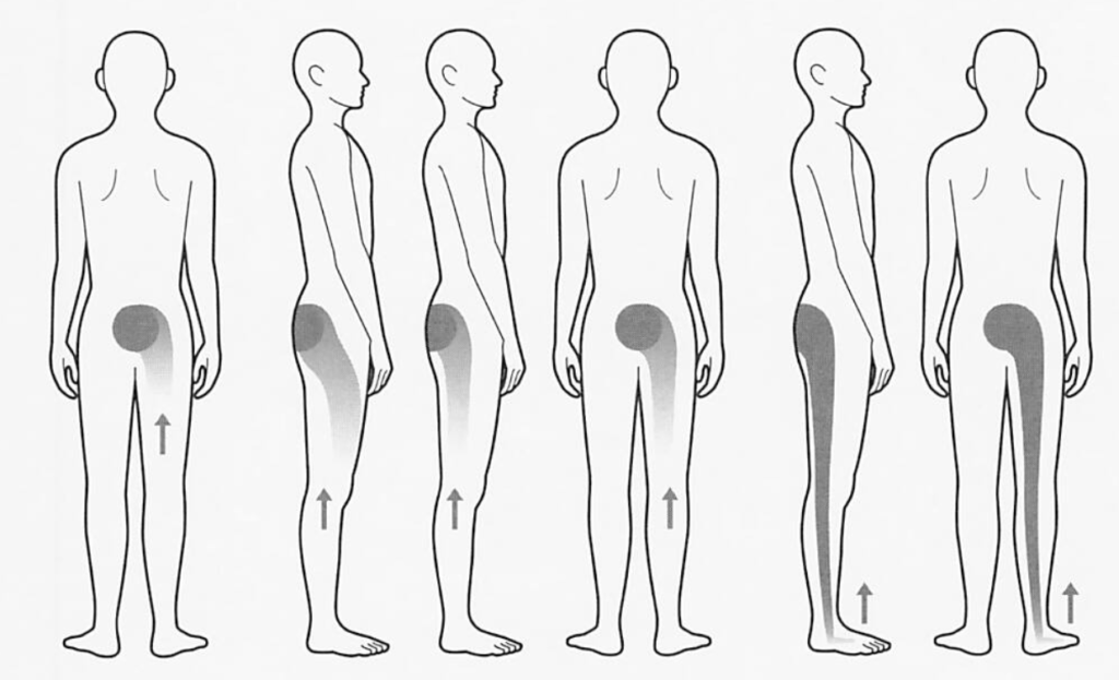 中央化現象|腰痛|マッケンジー体操