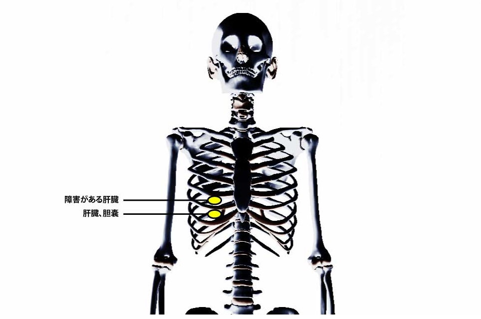 チャップマンの反射点治療｜内蔵マニピュレーション｜肝臓