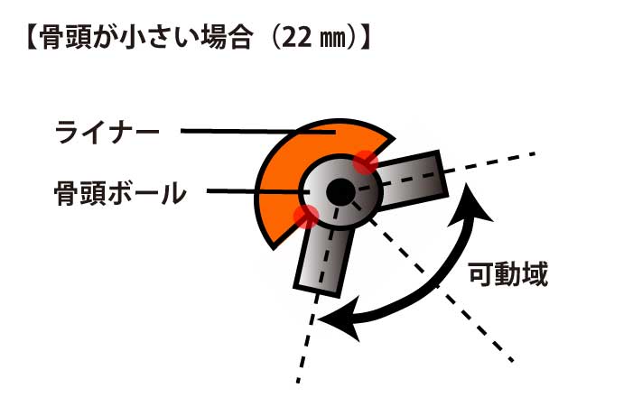 人工股関節｜骨頭22ミリ