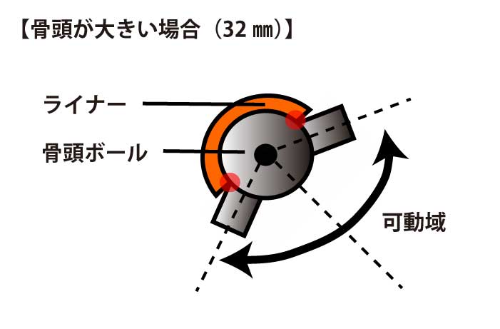 人工股関節｜骨頭32ミリ