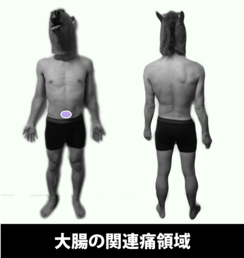 大腸の痛み｜関連痛領域