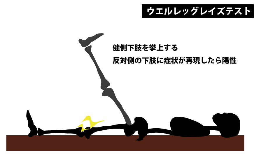 ウエルレッグレイズテスト