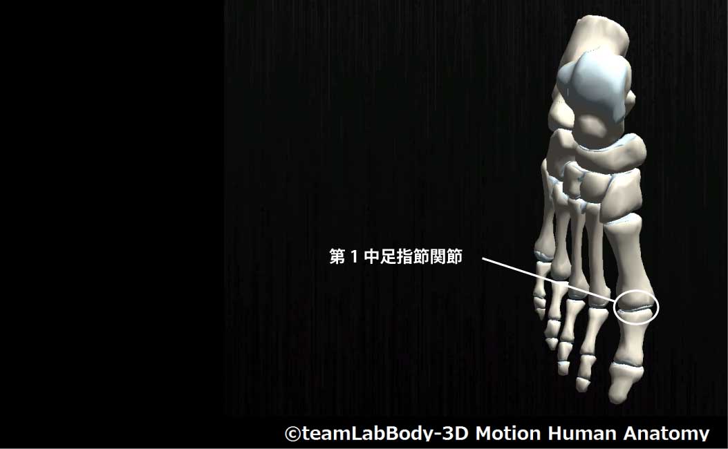 第1中足指節関節