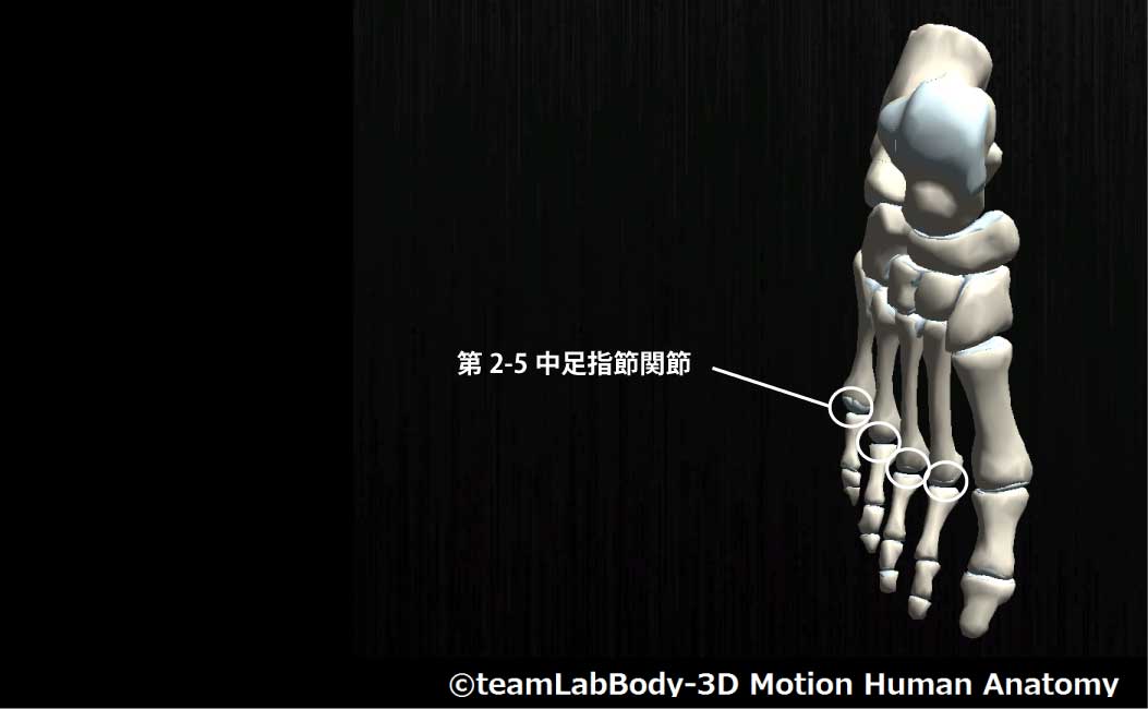 第2-5中足指節関節