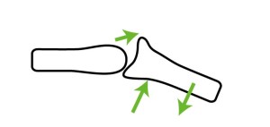 関節モビライゼーション｜傾斜（tilt）