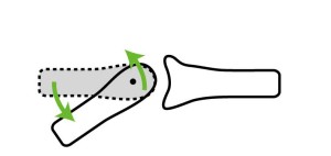 関節モビライゼーション｜凸構成滑り