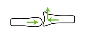 関節モビライゼーション｜接近遊び滑り（close-glide）