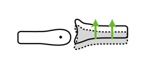 関節モビライゼーション｜遊び滑り（glide）