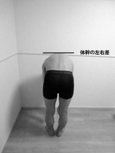 体幹前屈｜脊柱側弯の確認