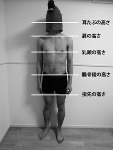 前額面の左右対称性｜立位姿勢の評価