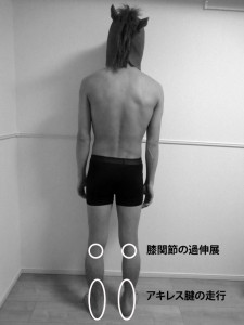 立位後面の姿勢評価｜アキレス腱の走行｜膝関節の過伸展