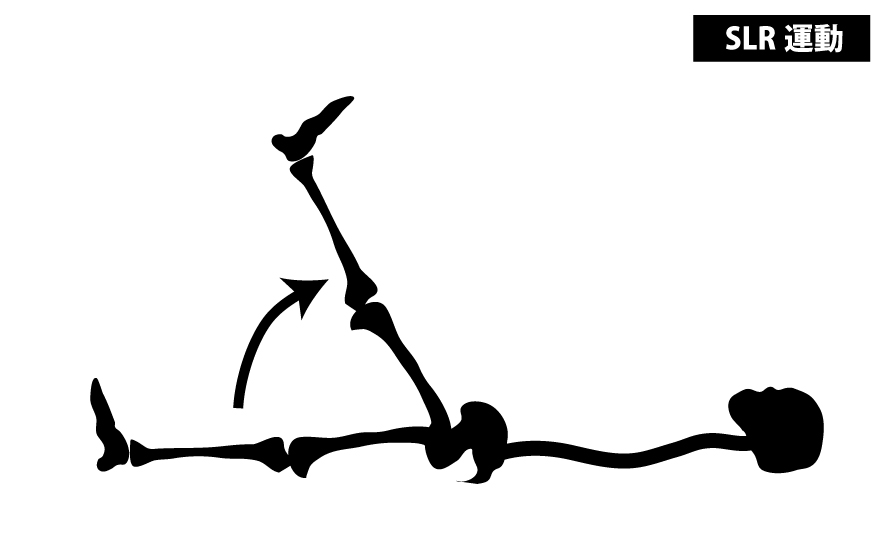 SLR運動