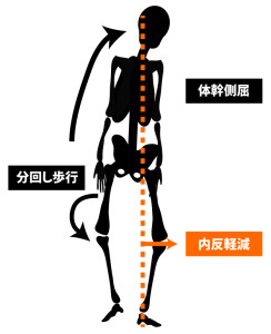 変形性膝関節症｜歩行姿勢｜体幹側屈歩行