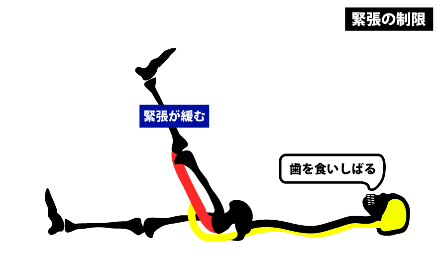 筋緊張によるSLR制限