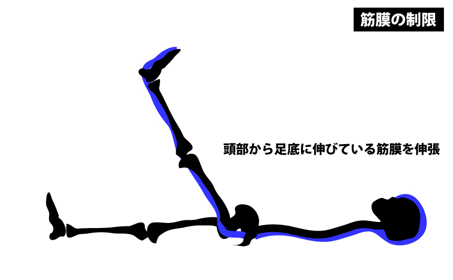 筋膜を用いたSLR伸張