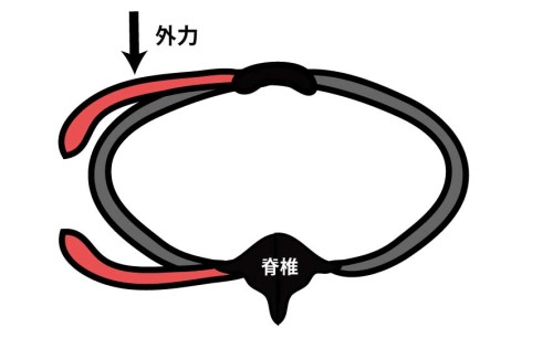 肋骨骨折｜介達外力