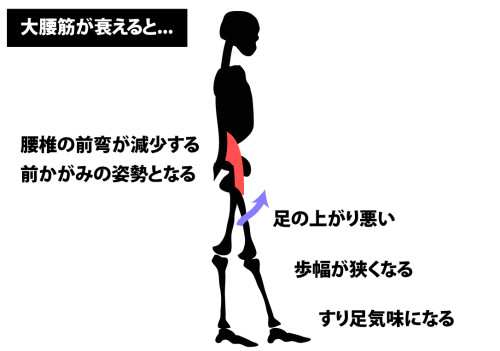 大腰筋が衰えた歩き方