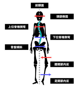 姿勢分析と運動連鎖｜前額面