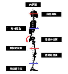 姿勢分析と運動連鎖｜矢状面