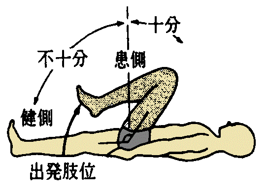 %e4%b8%8b%e8%82%a2%e3%83%96%e3%83%ab%e3%83%b3%e3%82%b9%e3%83%88%e3%83%ad%e3%83%bc%e3%83%a0%e3%83%bb%e3%82%b9%e3%83%86%e3%83%bc%e3%82%b8%e2%85%a2-2