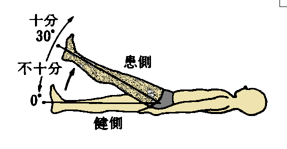 %e4%b8%8b%e8%82%a2%e3%83%96%e3%83%ab%e3%83%b3%e3%82%b9%e3%83%88%e3%83%ad%e3%83%bc%e3%83%a0%e3%83%bb%e3%82%b9%e3%83%86%e3%83%bc%e3%82%b8%e2%85%a3