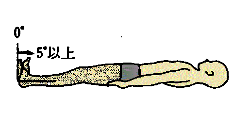 %e4%b8%8b%e8%82%a2%e3%83%96%e3%83%ab%e3%83%b3%e3%82%b9%e3%83%88%e3%83%ad%e3%83%bc%e3%83%a0%e3%83%bb%e3%82%b9%e3%83%86%e3%83%bc%e3%82%b8%e2%85%a4