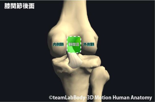 %e5%a4%a7%e8%85%bf%e9%aa%a8%e9%a1%86%e9%83%a8%e9%a1%86%e9%96%93%e7%aa%a9