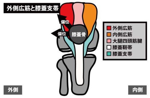 外側広筋と外側膝蓋支帯