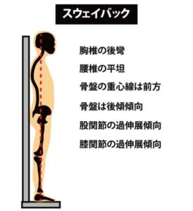 姿勢の分類：スウェイバック１