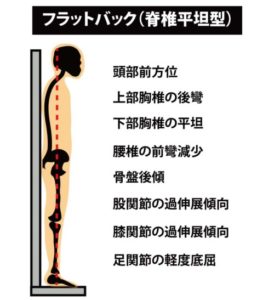 姿勢の分類：フラットバック