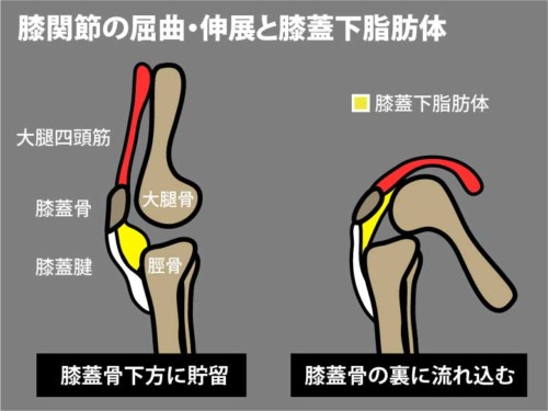 膝関節の屈曲伸展と膝蓋下脂肪体