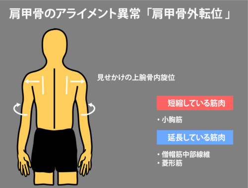 肩甲骨の場所と付着する筋肉について Rehatora Net