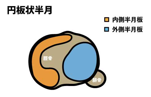 外側半月板損傷のリハビリ治療 Rehatora Net