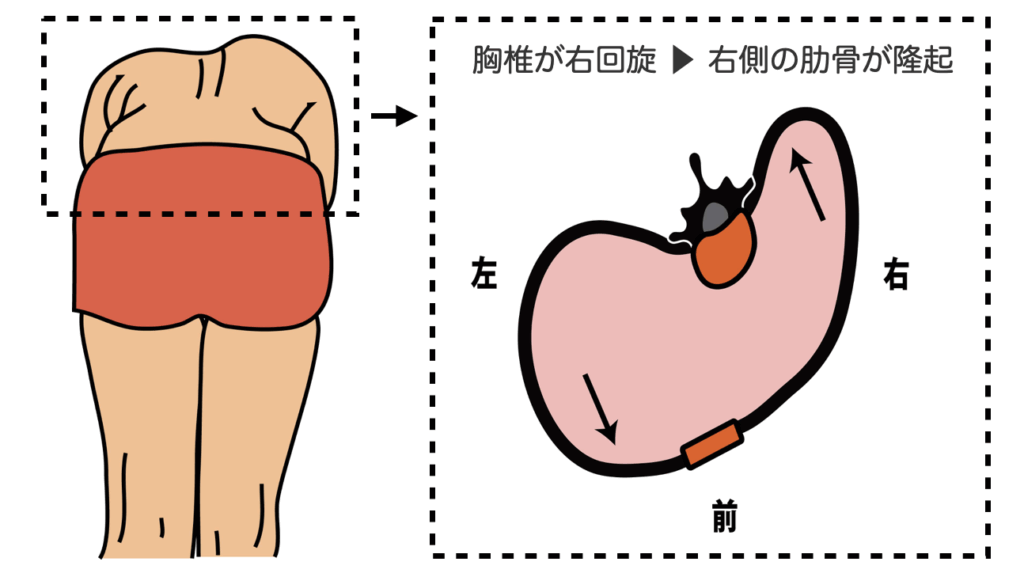 回旋：胸郭のリブハンプ